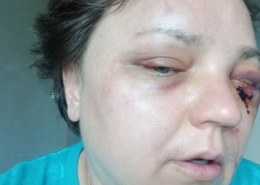 Петербурженку избил сосед-мигрант после просьбы помыть туалет коммуналки