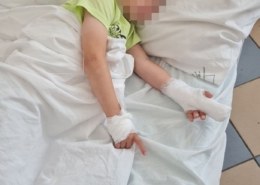 Юный петербуржец лишился пальца в туалете гипермаркета